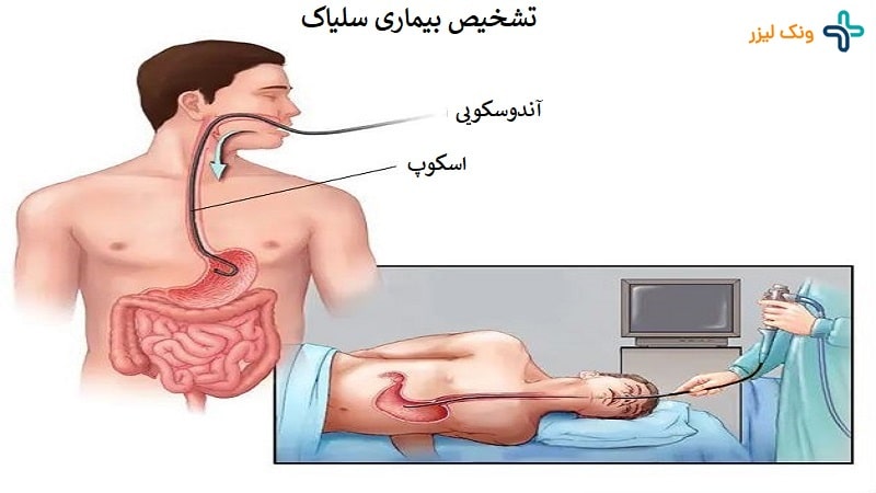 تشخیص سلیاک