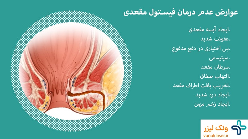 عوارض عدم درمان فیستول مقعدی