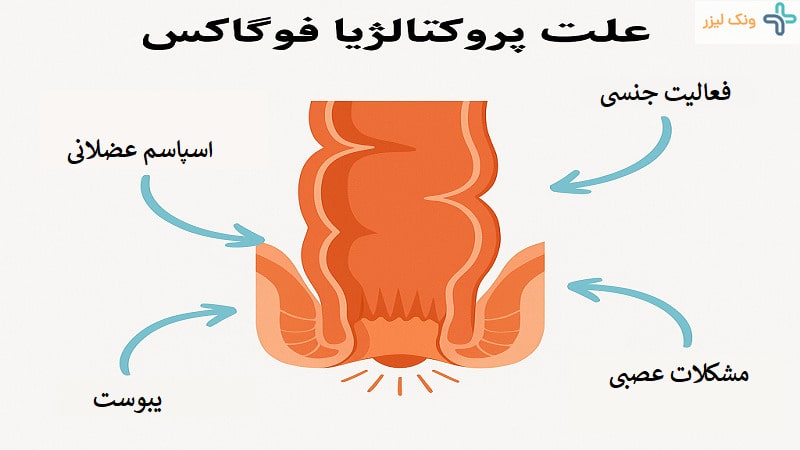 علت اسپاسم مقعدی