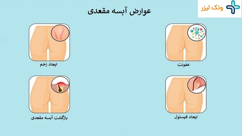 عوارض آبسه مقعدی