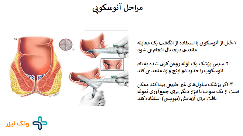 آنوسکوپی چگونه انجام میشود