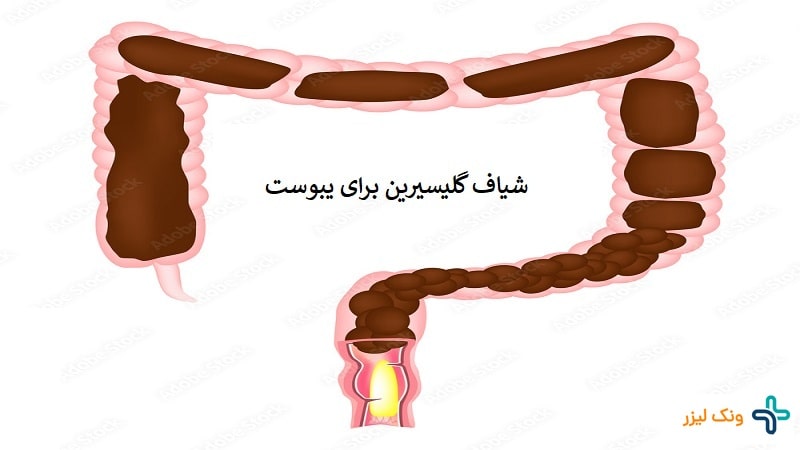 شیاف گلیسیرین برای یبوست