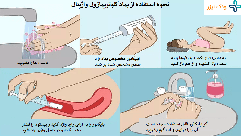 نحوه استفاده از پماد کلوتریمازول واژینال