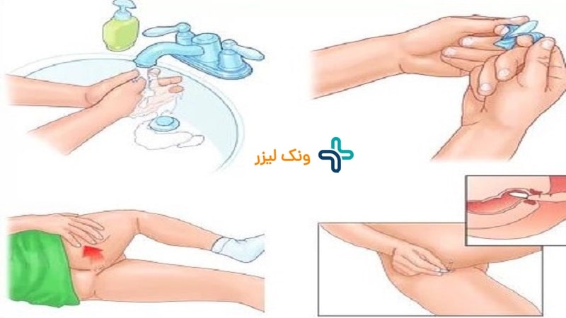 نحوه قرار دادن شیاف بیزاکودیل