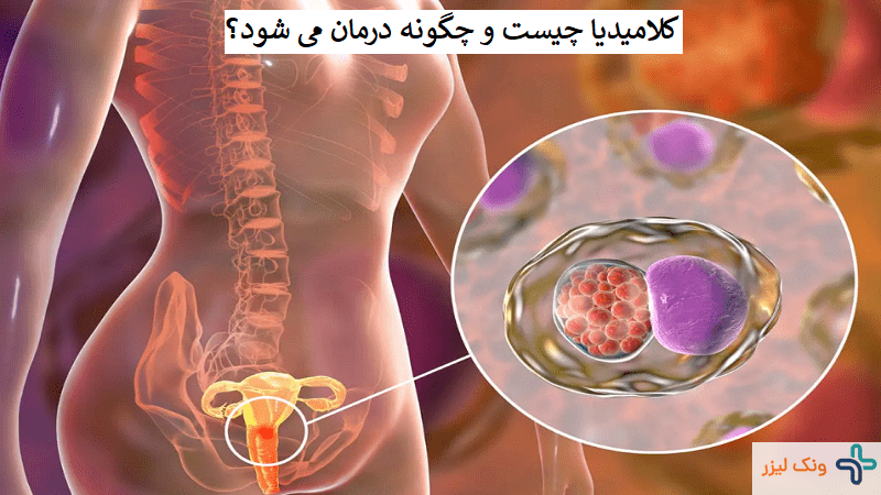 کلامیدیا