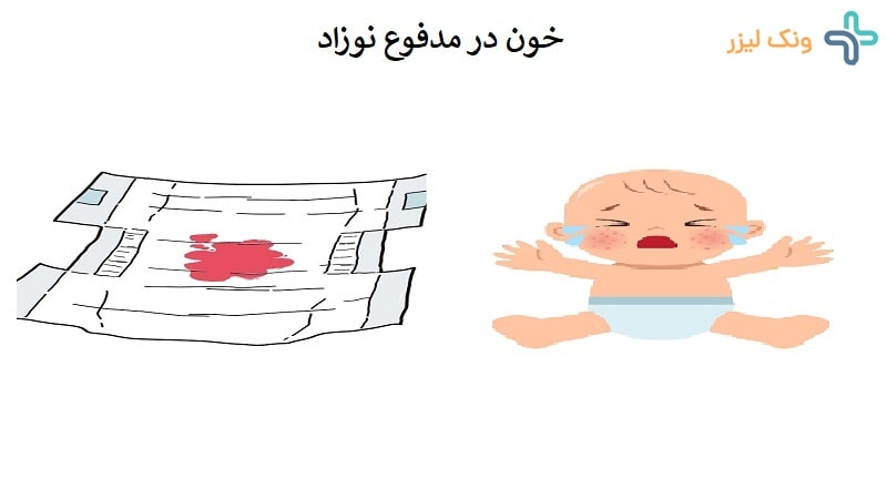 خون در مدفوع نوزاد