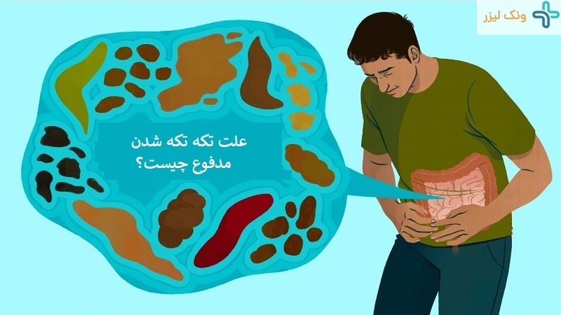 مدفوع تکه تکه