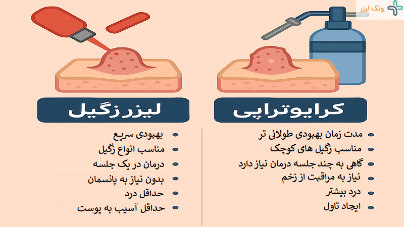 لیزر زگیل تناسلی بهتر است کرایو