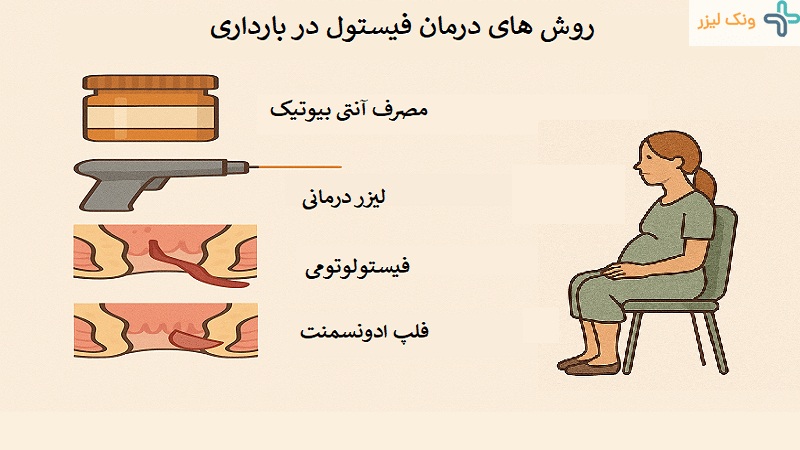 درمان فیستول در بارداری