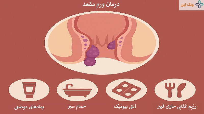 درمان ورم مقعد