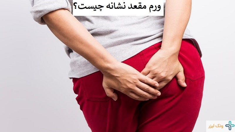 ورم مقعد