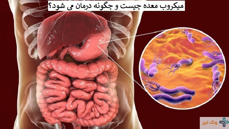 میکروب معده