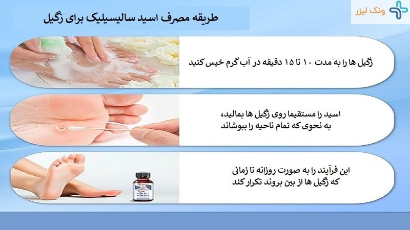 نحوه استفاده از اسید سالیسیلیک برای زگیل تناسلی