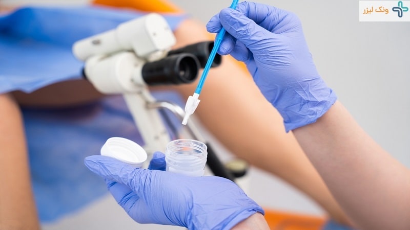 آزمایش HPV