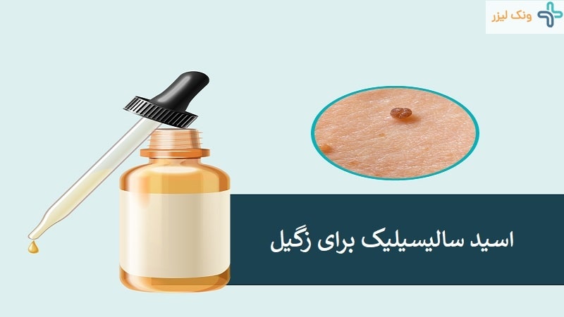 اسید سالیسیلیک برای زگیل تناسلی