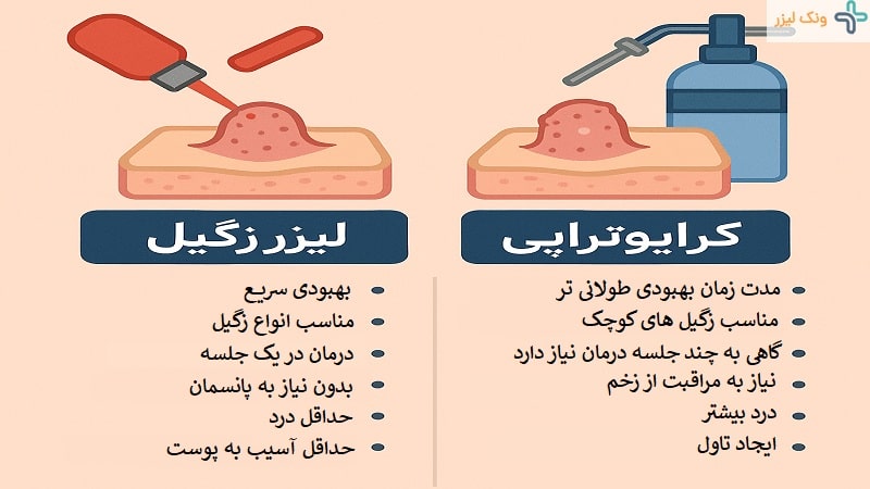 لیزر زگیل تناسلی بهتر است کرایو
