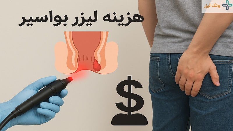 هزینه لیزر بواسیر چقدر است