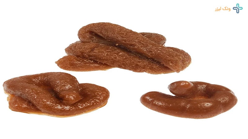 مدفوع چسبناک
