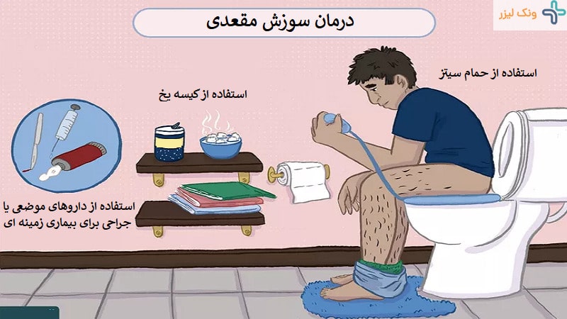 درمان سوزش مقعد