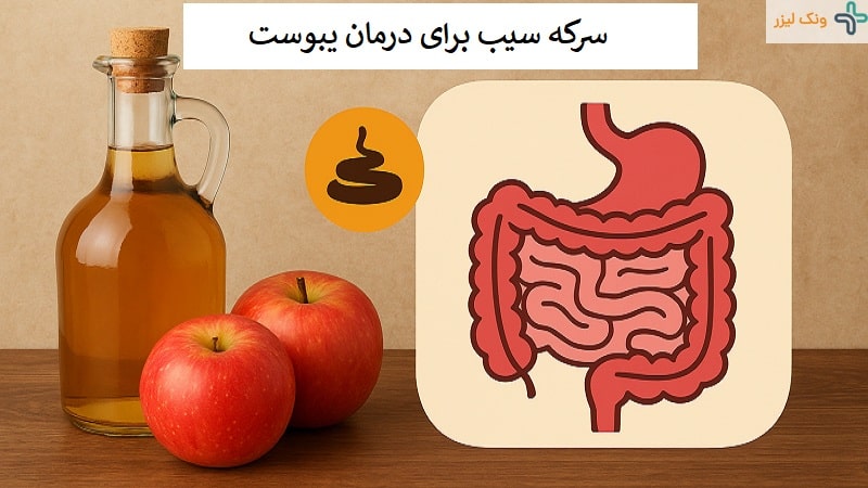 سرکه سیب برای یبوست