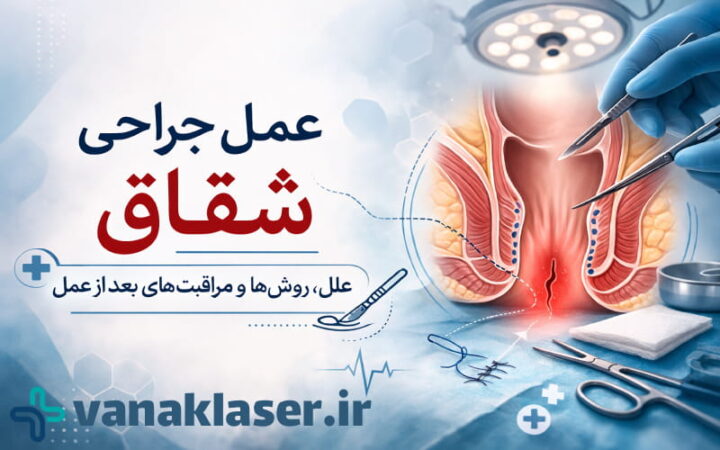 عکس عمل جراحی شقاق مقعد